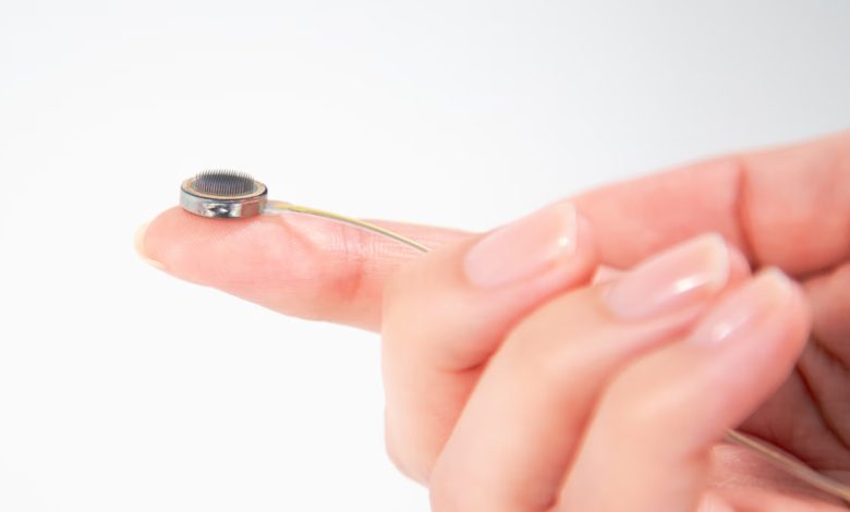 Rival da Neuralink testa seu 1º implante de chip cerebral em humano; entenda como ele funciona | Inovação