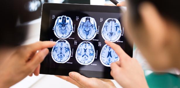 Médicos analisam tomografia do cérebro em um tablet
