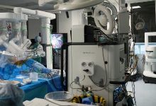 Esta foto, tirada em 3 de julho de 2026, mostra o cirurgião Sasha Stamenkovic (à extrema direita) -- diretor de cirurgia robótica, pesquisa e programas de especialização -- realizando uma cirurgia de câncer de pulmão com o novo sistema cirúrgico assistido por robô Da Vinci 5, com o auxílio de enfermeiros (à esquerda), no Hospital St. Bartholomew, em Londres